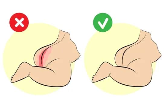 Jak wyglądają odparzenia u niemowlaka i jak im zapobiegać?