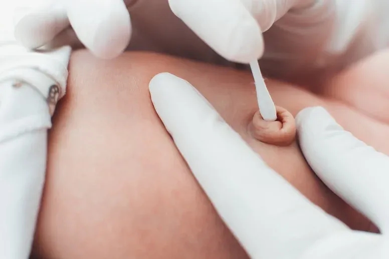Jak czyścić pępek niemowlaka - proste sposoby na zdrową pielęgnację