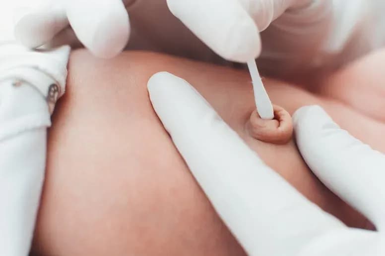 Jak czyścić pępek niemowlaka - proste sposoby na zdrową pielęgnację